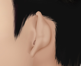 constricted ear