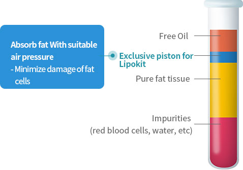 리포켓 전용 피스톤: 적절한 압력의 공압으로 지방을 흡입