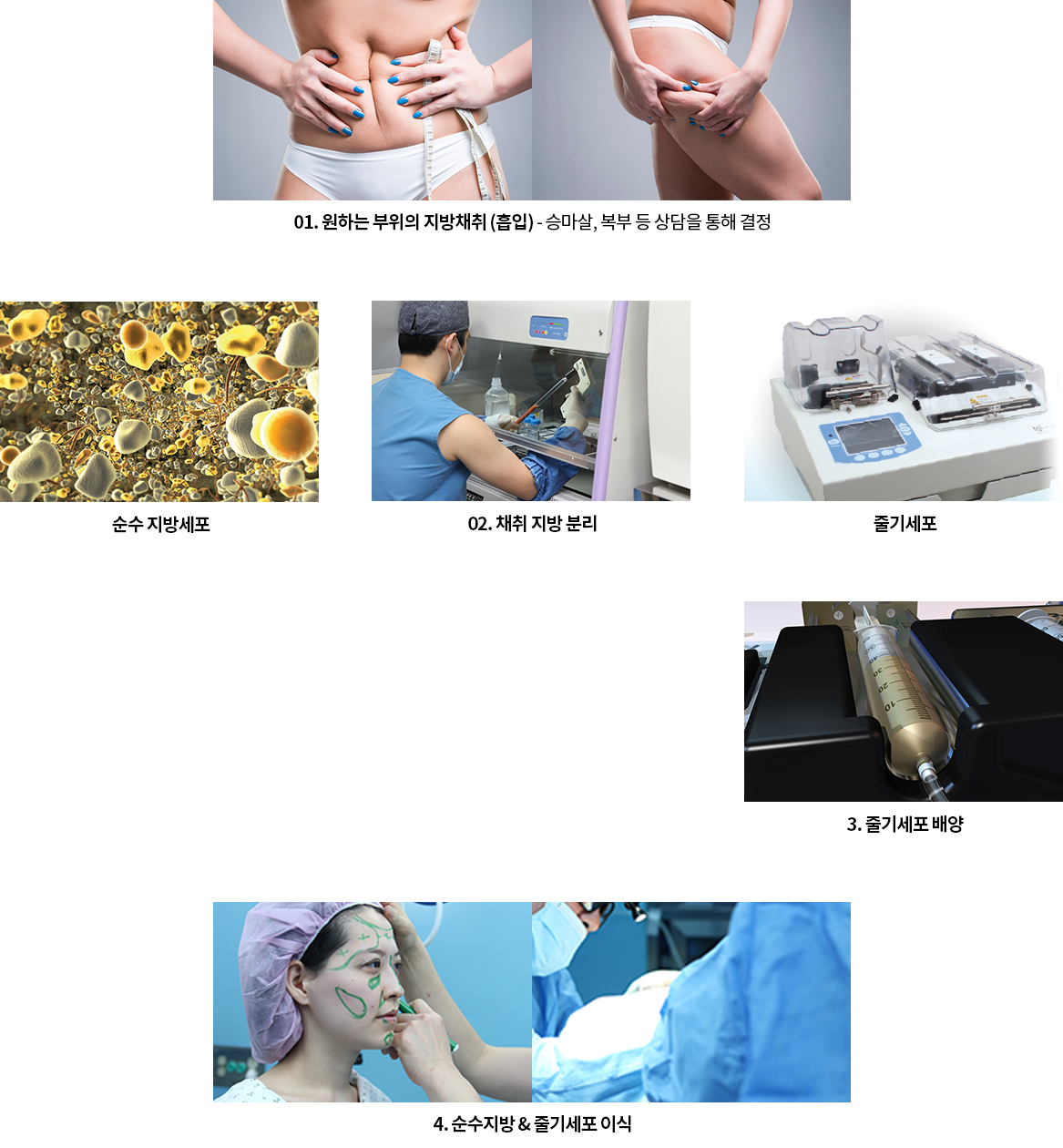 jk 줄기세포 Extraction Process