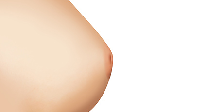 Inverted nipple