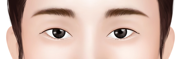 Oblique Eyes