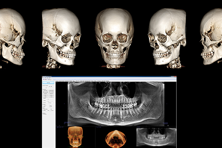 x-ray photo