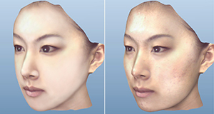 3-Dimensional Simulation (Virtual Surgery)