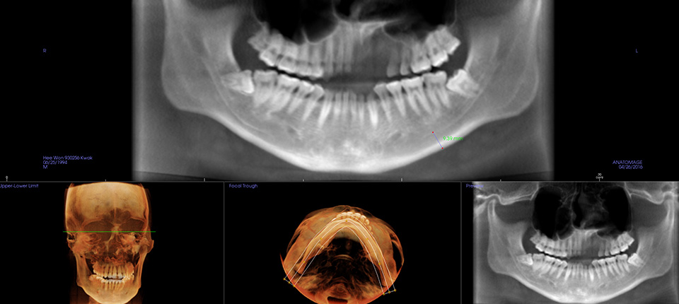Various Clinical Case and Innovative Devices and Facilities