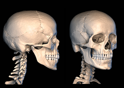 X-ray 검사 결과