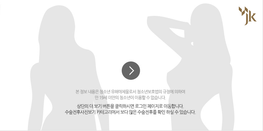 본 정보 내용은 청소년 유해매체물로서 청소년보호법의 규정에 의하여 만 19세 미만의 청소년이 이용할 수 없습니다.상단의 더 보기 버튼을 클릭하시면 로그인 페이지로 이동합니다.수술전후사진보기 카테고리에서 보다 많은 수술전후를 확인 하실 수 있습니다.