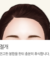 절개:견고한 봉합을 한뒤 충분히 휴식합니다.