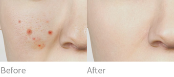 after before 이미지