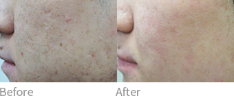 after before 이미지