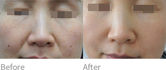 after before 이미지