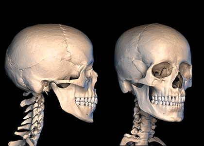 X-ray 검사 결과