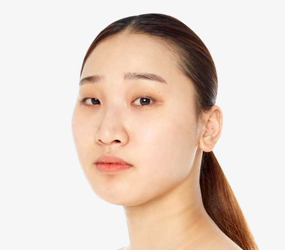 年のノウハウを持つ整形外科専門医が直々に執刀 Jk顎整形 韓国政府認証jk美容外科