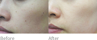 after before 이미지