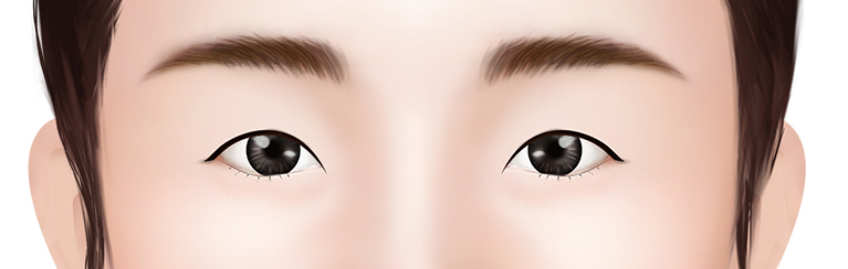Маленькие глаза с тонкой кожей