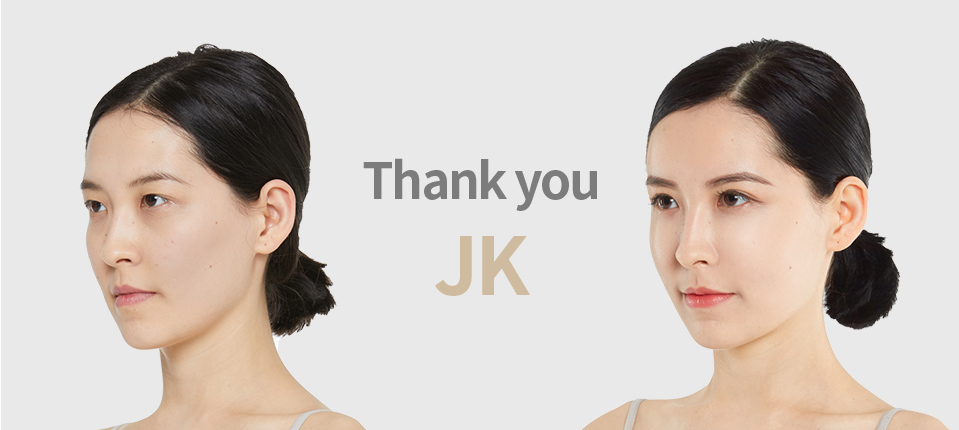 Специалисты JK помогут создать красивую и естественную форму глаз.